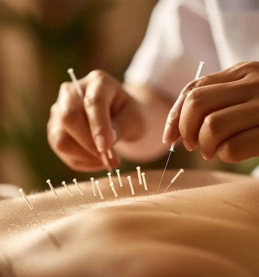Acupuncture Assistance